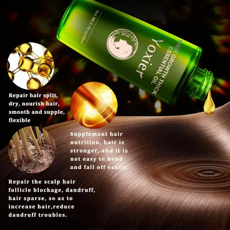 Yoxier Vaistažolių Plaukų Augimą Eterinis Aliejus, Šampūnas, Plaukų Priežiūros Stiliaus Plaukų Slinkimas Produktas Storio Greitas Remontas Auga Valymo Skystis 0