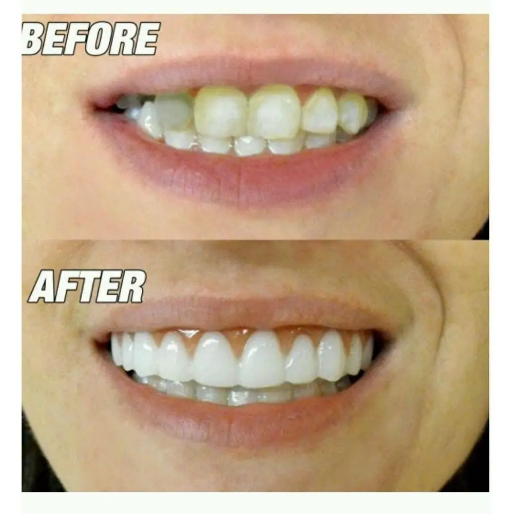 Dirbtiniai Dantys Dantų Padengti Puikus Juoktis Laminatės dantų Protezų Higienos Petnešos Netikrą Už Dantų Priemonės Apima Pasta Kosmetikos Žodžiu H7C3 5